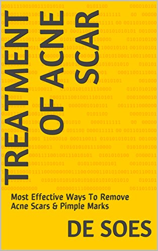 most effective way to remove acne scars