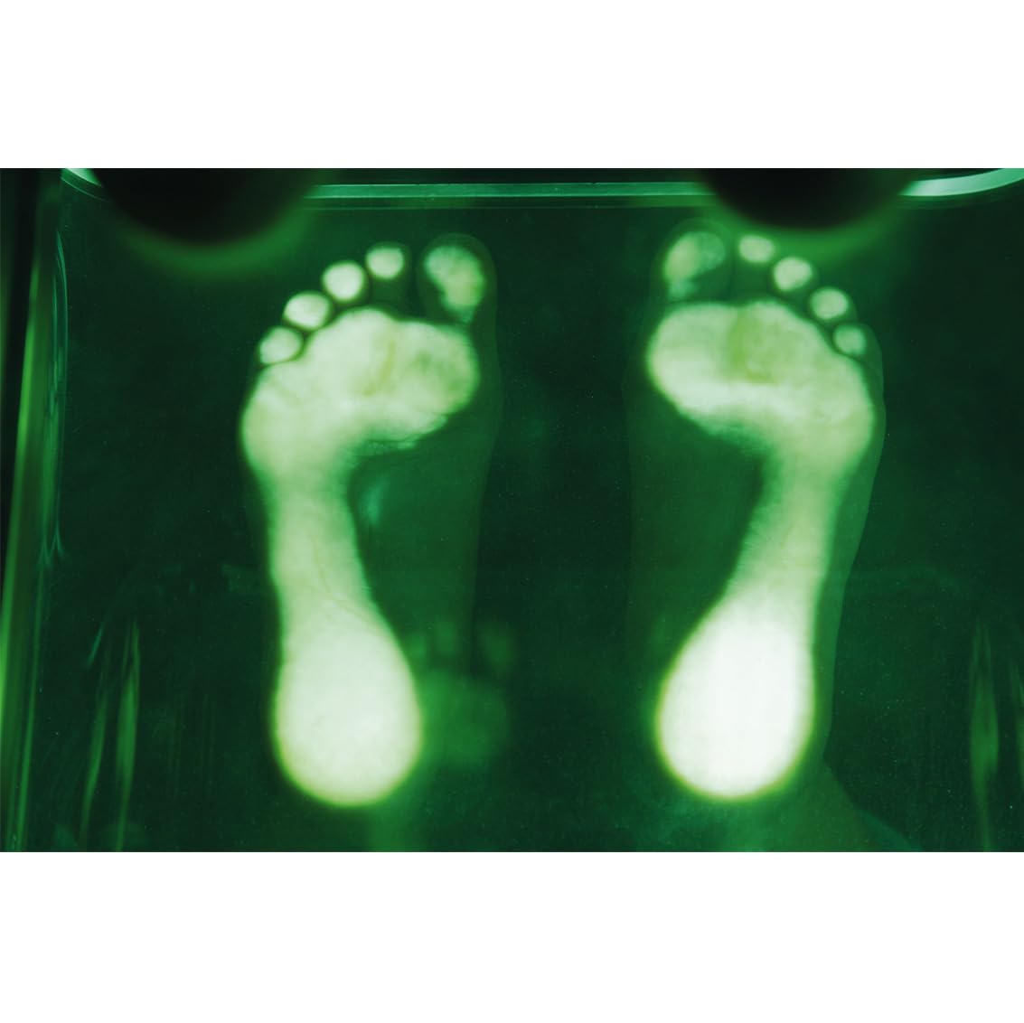 Gima 27363 Podoscopio a LED