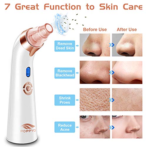 Blackhead Remover Pore Vacuum - Electric Blackhead Vacuum Cleaner Blackhead Extractor Tool Device Comedo Removal Suction Beauty Device for Women(Rose Gold)