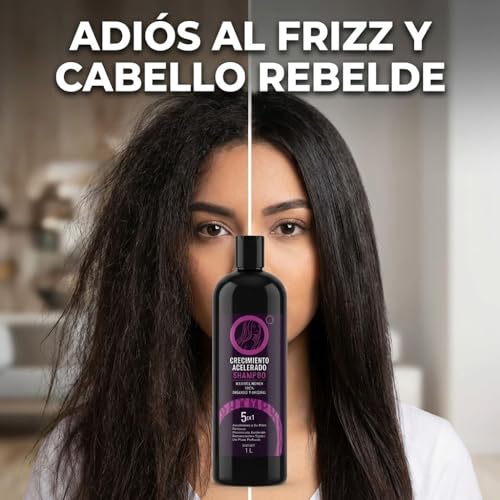 La mejor comparación de Shampoo crece favoritos de las personas. 21 La mejor comparación de Shampoo crece favoritos de las personas. 13