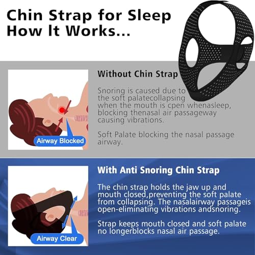 image for Yongsenina Chin Strap for Sleeping, Effective Anti Snoring Devices, Ai