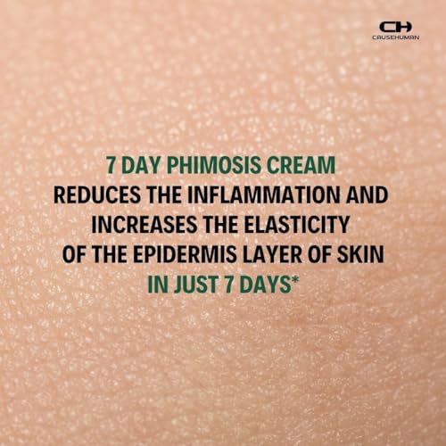 Image of 7-Day Phimosis Cream | Steroid-Free Treatment for Fast Relief at Home | Visible results in 7 Days* | 90ml | No irritation | For Phimosis