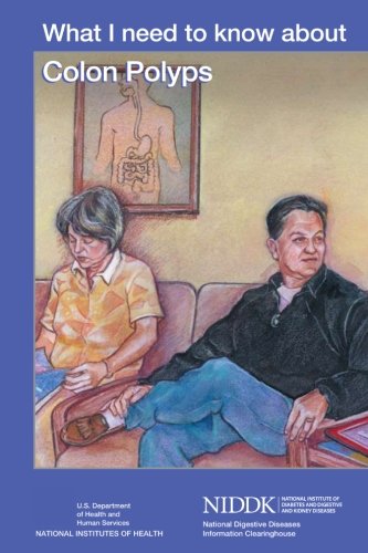 What I Need to Know About Colon Polyps