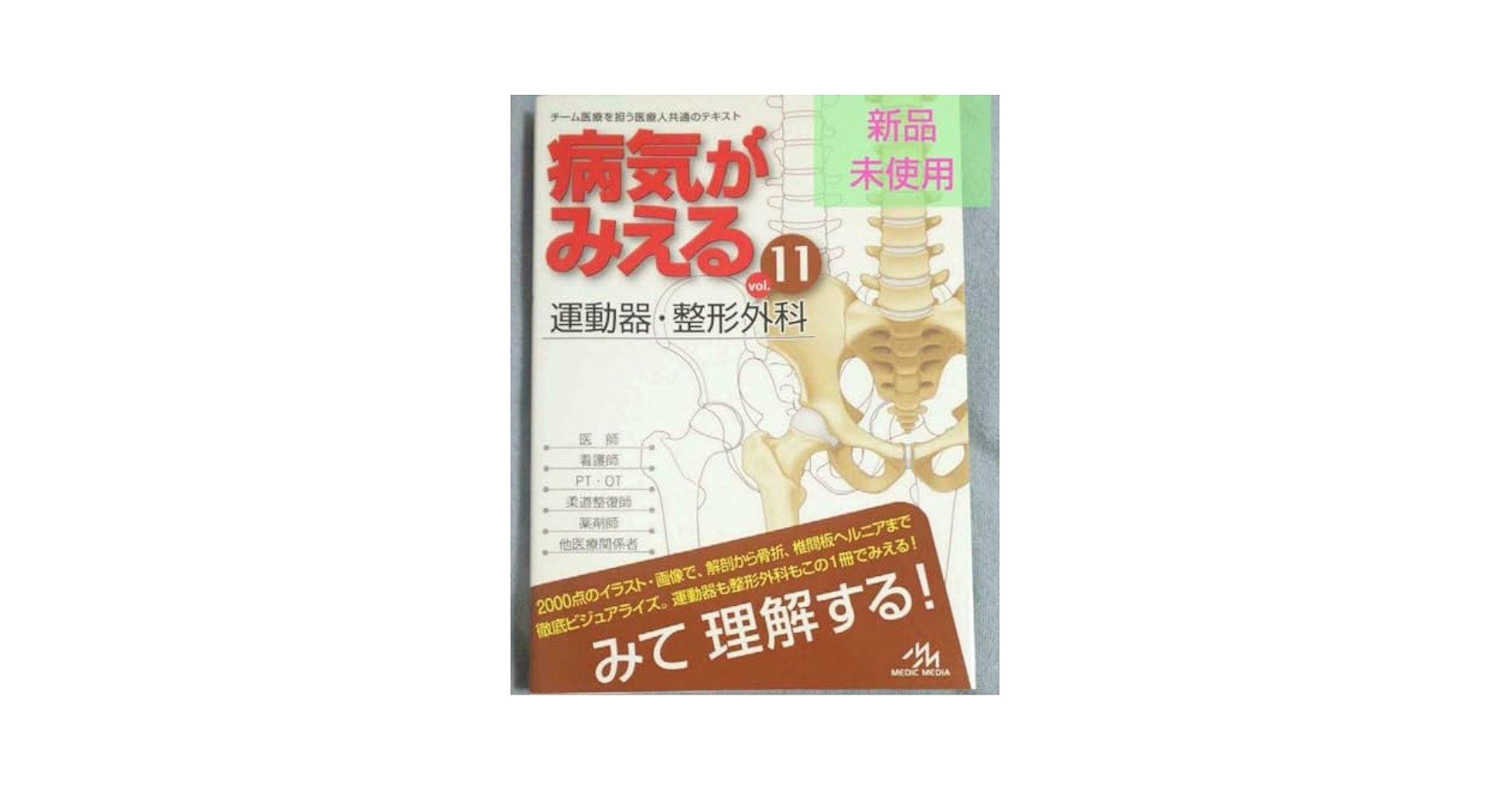 Amazon.co.jp: 病気がみえる vol.11 運動器整形外科 : おもちゃ