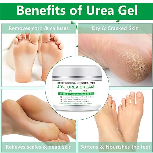 Urea 40% Foot Cream, 100g Callus Remover For Dry And Hard Skin, Cracked Heel Repair Cream For Feet and Hand, Maximum Strength With 2% Acid for Hand, Foot and Body Care - Image 3