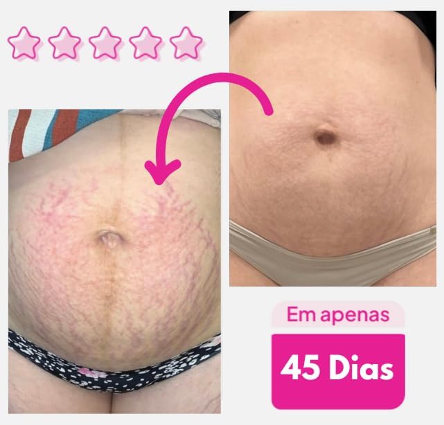 ADEUS Firming Body Cream - Anti-Cellulite Treatment