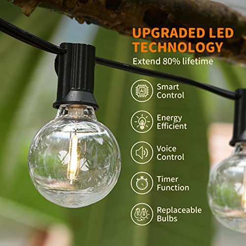 Xmcosy+ Smart Outdoor String Lights, 150Ft G40 Globe Patio Lights With 75 Led Bulbs, Wifi & App Control, Work With Alexa, Extendable Waterproof Dimmable Led String Lights For Outside, Porch, Cafe #TOP6