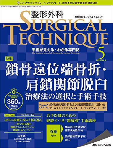 無料電子書籍 pdf 整形外科サージカルテクニック 2019年5号(第9巻5号)特集:鎖骨遠位端骨折・ バイ
