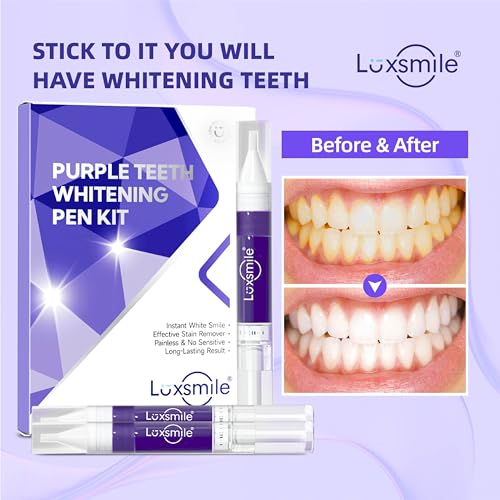 Image of Teeth Whitening Gel Pens V34 Purple Teeth Whitener Non Sensitive 25% Carbamide Peroxide Teeth Color Corrector Whitening, (3X) 4ml / Pen
