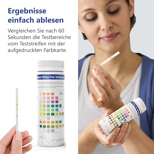 100x LuxmedIQ Urin Teststreifen - 10 Parameter Harnteststreifen - Teste auf Harnwegsinfektionen, Blasenentzündungen, Säure-Base Haushalt, Ketose, Diabetes, Leber- & Nierenerkrankungen, Blut im Urin