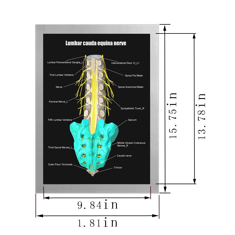 Image of Taanfu Body Educational Learning Anatomy Posters ，Equina Nerve Art Nerve Villi Anatomy Art Poster Digestive System Organs Illustration Small Intestine Physiology Anatomy Wall Art Villi