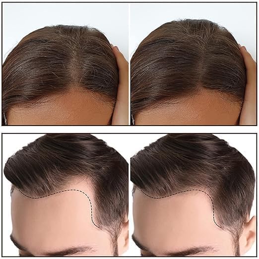 Image of Hairline Powder Stick for Men & Women | Waterproof Root Touch Up Powder for Grey & Thinning Hair | 3-in-1 Hairline Concealer, Eyebrow & Scalp Filler | Instant Natural Coverage, Long Lasting (Black)