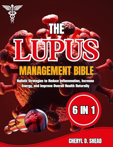 THE LUPUS MANAGEMENT BIBLE: Holistic Strategies to Reduce Inflammation, Increase Energy, and Improve Overall Health Naturally