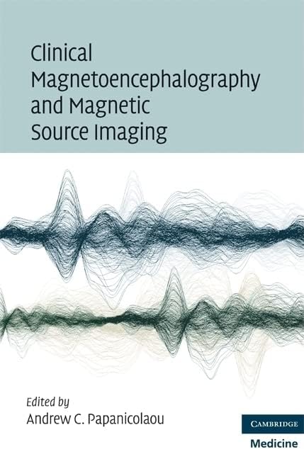 Clinical Magnetoencephalography and Magnetic Source Imaging