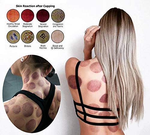 Muchoo Cupping Set Professional Chinese Acupoint Cupping Therapy Sets Suction Hijama Cupping Set With Vacuum Magnetic Pump Cellulite Cupping Massage Kit 22-Cup #TOP3