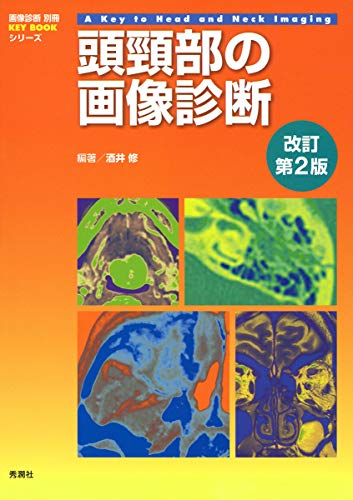 無料電子書籍 おすすめ 頭頸部の画像診断 改訂第2版 (画像診断別冊KEYBOOKシリーズ) バイ