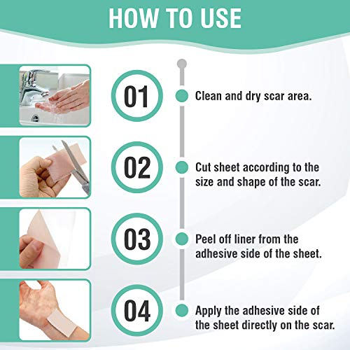 8Pcs Silicone Scar Removal Sheets, Washable Scar Strip Remover, Reusable Scar Sheet For Surgery Scars, Stretch Marks, Burns, Keloids, C-Section, Acne In Recent/Old Scars #TOP1