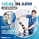 FORTEMOTUS Ellenbogen Bandage, Schiene Kubitaltunnelsyndrom Ellenbogen Orthese Verstellbar Winkel Armbandage für Tennisarm Golfer Sehnenscheidenentzündung für Links und Rechts, Damen, Herren, L