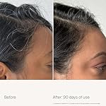 Living Proof Scalp Care Density Serum - Image 3