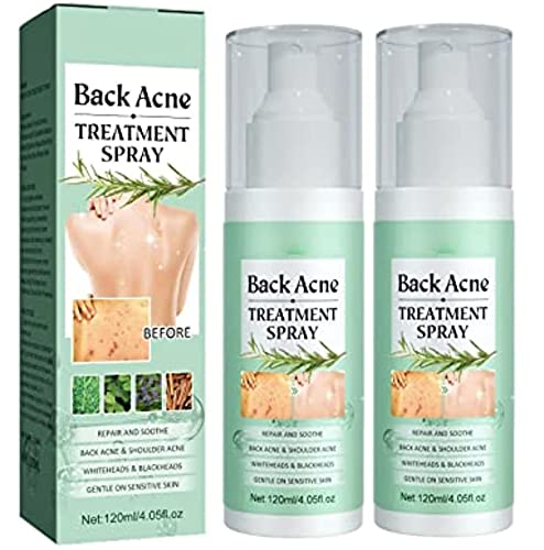 2 unidades Toxiklenz Spray para el tratamiento del acné de la espalda, spray para el acné de la espalda, solución para el acné de la espalda, para reparar el acné del hombro