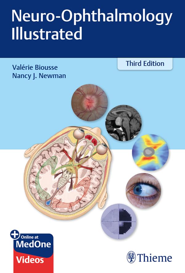 Neuro-Ophthalmology Illustrated (English Edition)