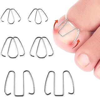 6 Pcs 3 Sizes Ingrown Toenail Wire Toenail Corrector Recover Care Nail Tool Stainless Steel Ingrown Toenail Correction for Ingrown Toenails Care Curve Correct Ingrown Toenail Treatment