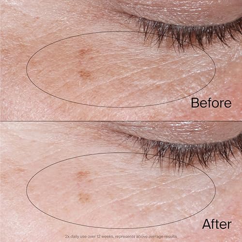 Neutrogena Collagen Bank Reviving Eye Cream, Fragrance Free, 0.5 oz - image 5