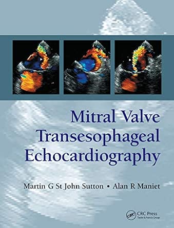 Mitral Valve Transesophageal Echocardiography-Wow! eBook