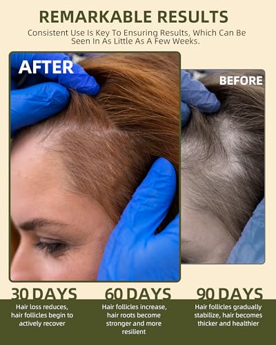 Ktintar 100% Natural Raw Batana Oil for Hair Growth, Dr Sebi Hair Growth Oil From Honduras, Thicker & Stronger Hair, Prevents Hair Loss, Eliminates Split Ends 4.23 Fl Oz (Pack of 1) — view 3