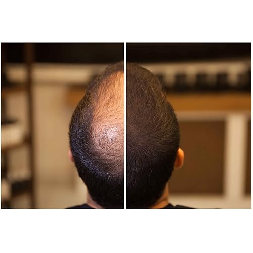 Miniatura 6 de Espesante de cabello de 0.54 onzas  Nueva fórmula impermeable  Cabello natural y de aspecto más completo en 30 segundos  Fibras capilares para