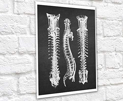 Gnosis Picture Archive Neurology Anatomy of Spinal Cord Backbone Set of 3 unframed Medical Decor Art Prints by Gnosis Picture Archive - Used condition - Image 4