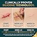 Silicone Scar Sheets, Silicone Scar Tape for Surgical Scars - Clinically Validated Technology Scar Treatment Strips for Hypertrophic, C-Section, Tummy Tuck, Keloid Scars - Reusable, Waterproof