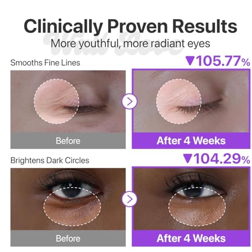 Image of No.9 Advanced NAD+ Retinol Eye Cream - Anti-Aging & Depuffing Eye Serum for Dark Circles, Fine Lines & Wrinkles - Peptides + Niacinamide for Firming, Radiance & Glow - Hydrating Undereye Treatment - 0.33 fl oz
