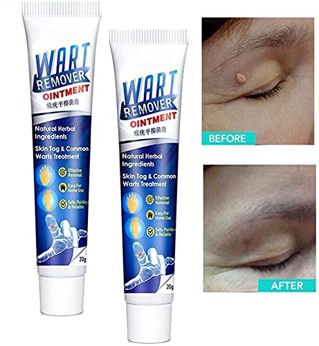 Rimozione della verruca Crema per il trattamento