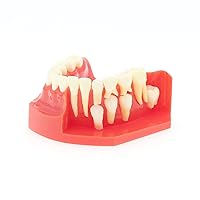 Vista 4 de Dientes Typodonts Modelo dental # 7013 - Modelo de desarrollo de erupción de dientes Modelo alternativo de presión constante de dientes caducifolios