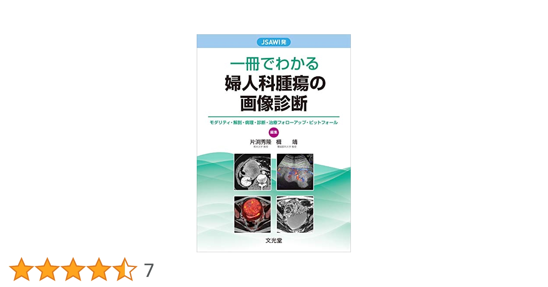 【医学書】産婦人科の画像診断 産婦人科の画像診断 | 田中優美子 |本 | 通販 | Amazon