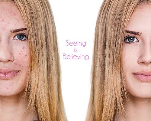 Dinair Airbrush Makeup Foundation | Vanilla 1.15 Oz | Camouflage Neutralizer - Covers Scars, Acne, Tattoos, Vitiligo, Under Eye Circles, Sun Spots #TOP6