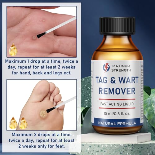 Image of inchSTAY STOKED inch Wart Remover, 15ml Liquid Wart Freeze Off - Salicylic Acid Formula with Brush Applicator-QQ1