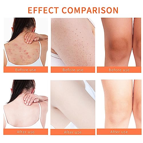 Turmeric Body Scrub - Remove Acne Dark Spots - Turmeric Exfoliating Body Scrub - Smooth Skin Deep Cleansing Moisturizing Hyperpigmentation - Great Gifts Women Body Scrub for Deep Cleansing (Turmeric) - Image 6