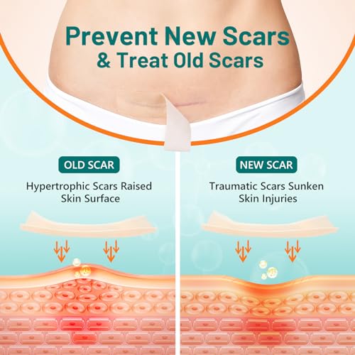 HALIDODO Silicone Scar Tape Professional Silicone Scar