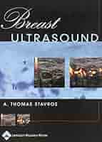 健康・医学 Breast Ultrasound A. Thomas Stavros 91rFXR-7yLL._UF894,1000_QL80_.jpg