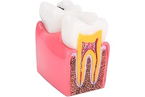 Teeth Model for Dental Caries Analysis and Education