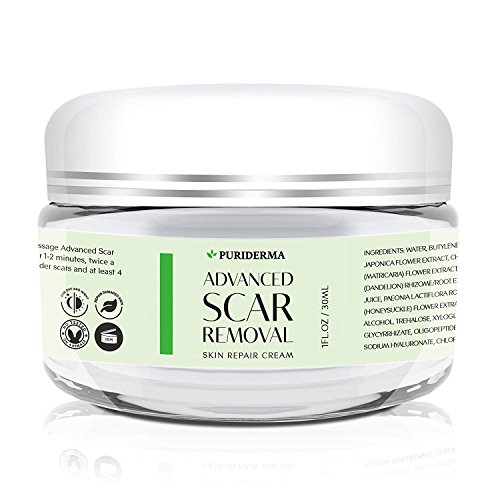 Scar Removal Cream - Advanced Treatment for Face & Body, Old & New Scars from Cuts, Stretch Marks, C-Sections & Surgeries - With Natural Herbal Extracts Formula