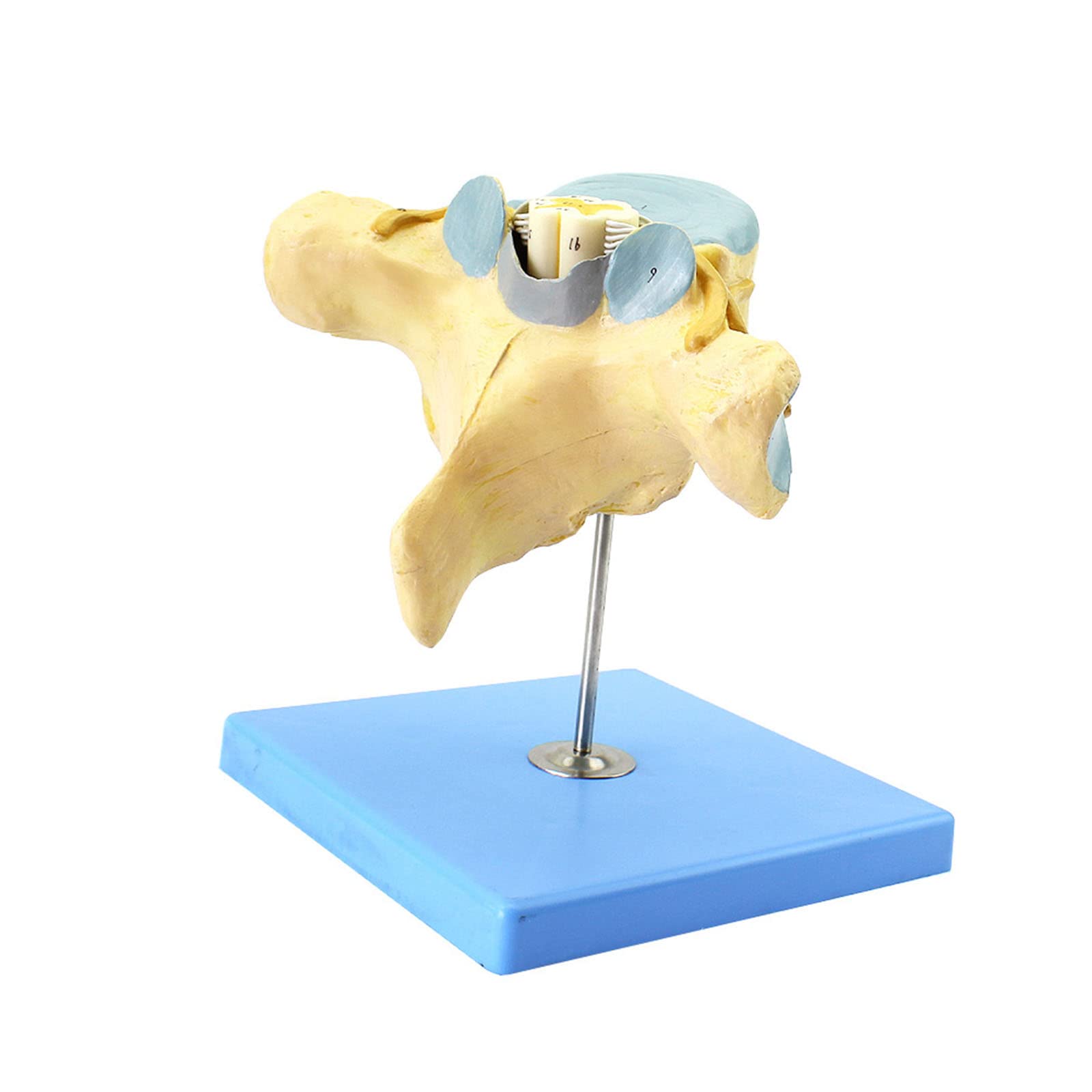 Anatomy Models, Enlarged Model of Human Cervical Vertebrae with Spinal Cord and Nerves Neuro-Orthopedics Anatomical Teaching