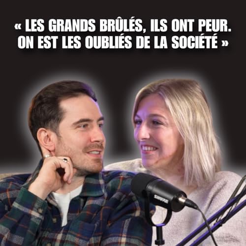 Page de couverture de Julie BOURGES : Brul&eacute;e vive &Agrave; 16 ans, elle survit aux flammes, transforme son destin et inspire 650 000 personnes !