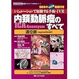 内頚動脈瘤(ICA Aneurysm)のすべて-遠位部(supraclinoid): シミュレーションで経験する手術・IVR/50本のWEB動画付き (脳神経外科速報EX部位別に学ぶ脳動脈瘤シリーズ)