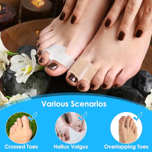 Image of 4 Pack Gel Toe Separators, Toe Spacer Toe Separators for Overlapping Toes Hammer Toe Straightener Hammer Toe Corrector for Women Men Bunion Corrector with 2 Loops for Feet,