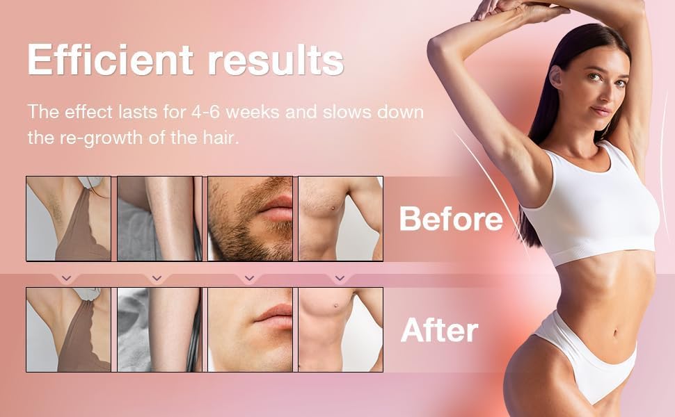Image of Hair Removal Wax Kit Wax Heater Machine Roll on Hair Removal Wax Kit Wax Heater machine,Refill Cartridge Strips With Wipes Waxing kit for Women Waxkit (wax Roller Heater Machine Combo)