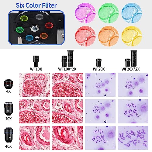 Microscope Kit With Case For Students Adults, 40X-1600X Magnification, Powerful Biological Children's Microscope Set For School Laboratory Home Scientific Research Education #TOP2