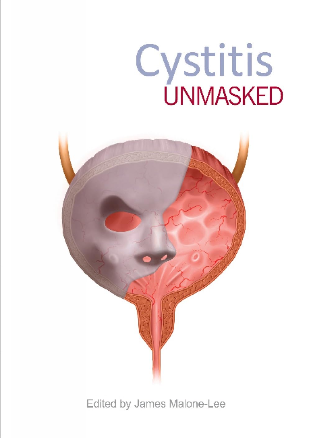 Cystitis Unmasked by James Malone-Lee (Paperback Book)